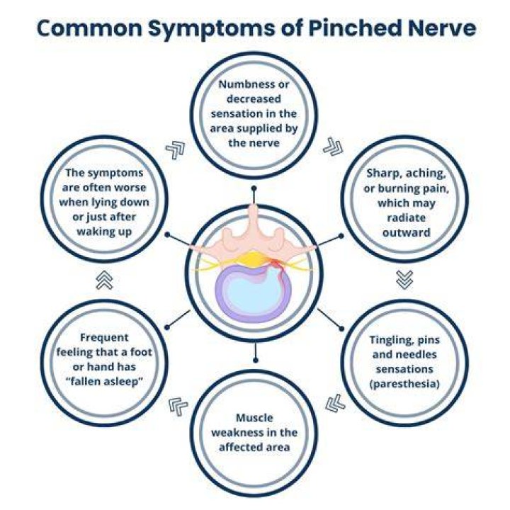 Can a pinched nerve cause earache?