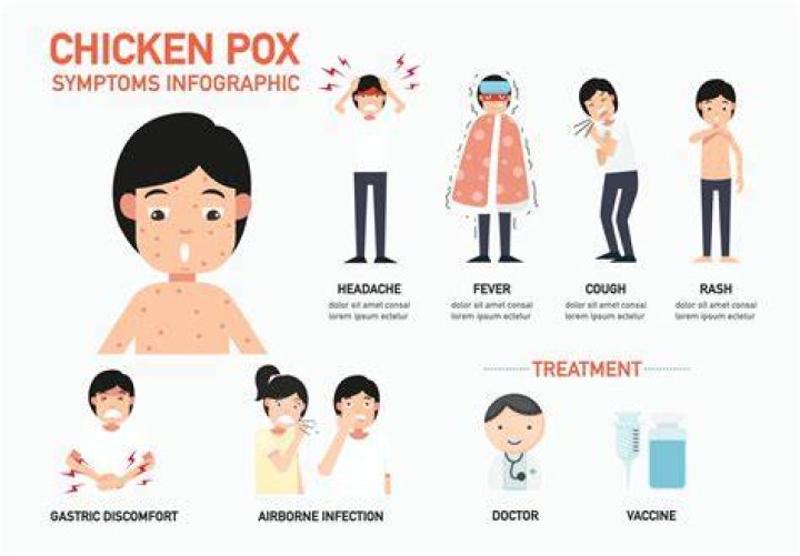 Is chicken pox catching?
